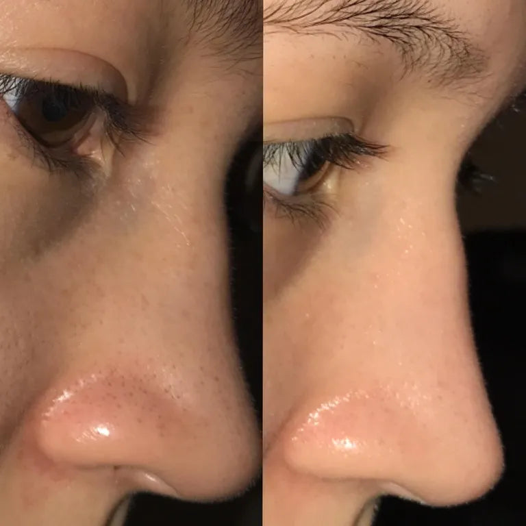 Before and After